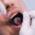 Частные стоматологи врут тюменцам, чтобы заманить их на прием
